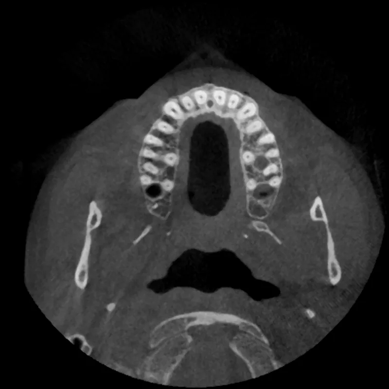 axial slice of a J. Morita head phantom scan