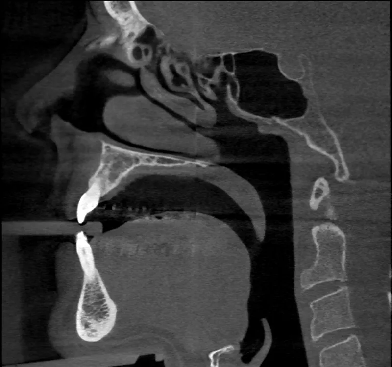 sagittal slice of a J. Morita head phantom scan